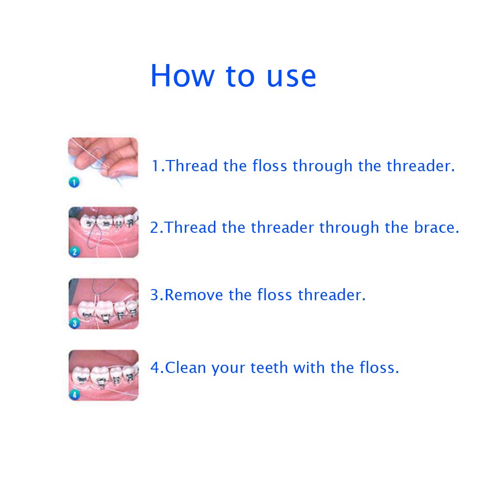 EasyHonor Dental Floss Threaders (Green) – Braces, Bridges & Implants, 210 Count (6 Pack)