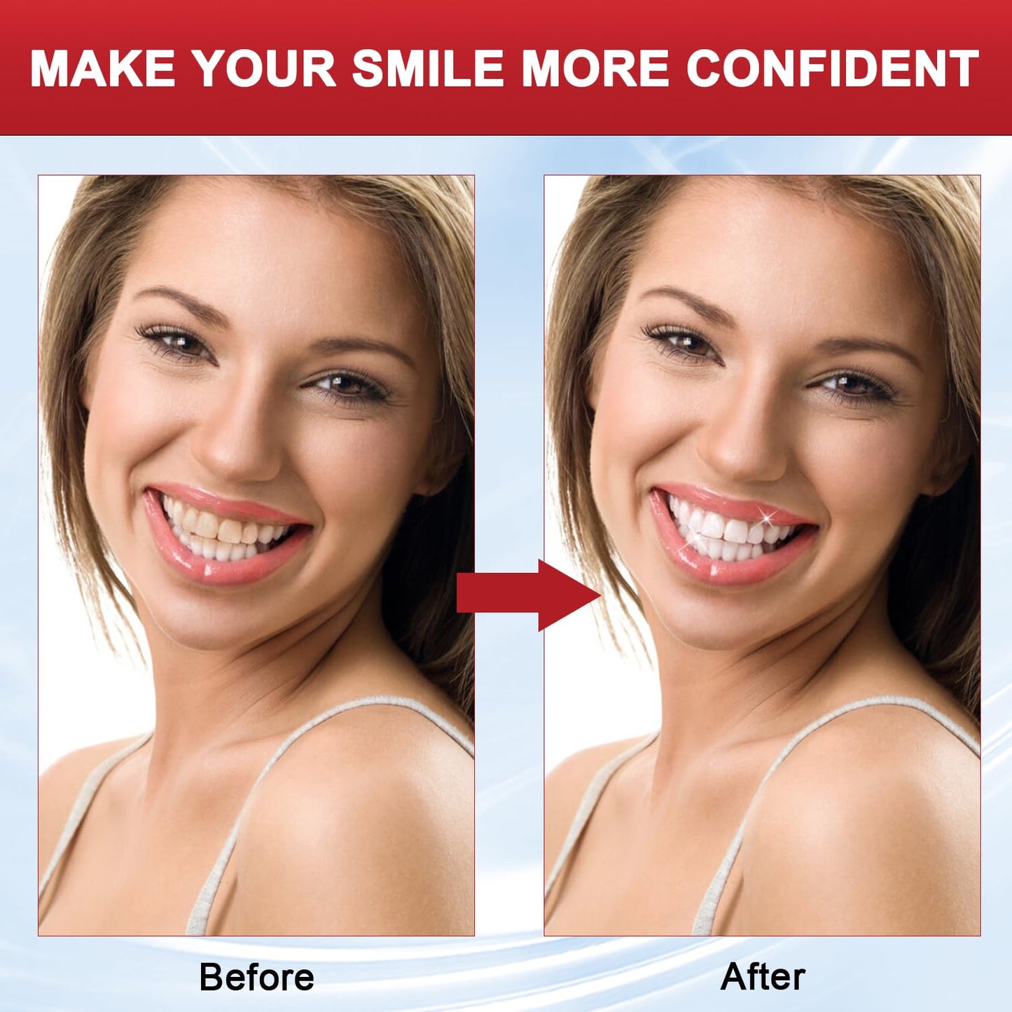 Sp8 Probiotic Brightening Toothpaste – SP-8 Ultra Whitening, 2 Tubes + 2 Toothbrushes