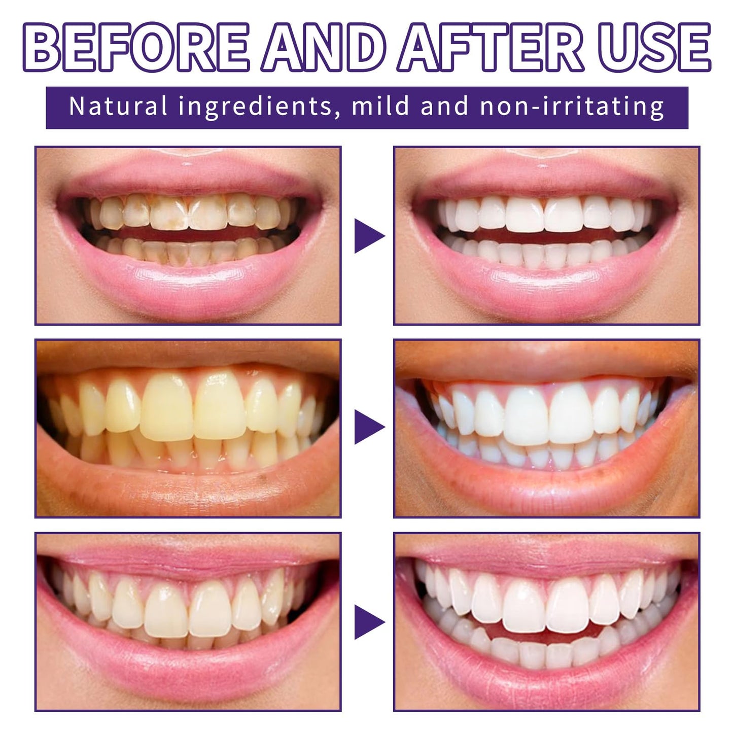 Tpyag Teeth Restoration Mineral Powder – Strengthen Teeth & Gums, Fresh Breath, Coffee/Tea/Tobacco Stains, 50g