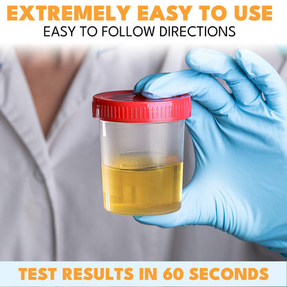 14-URS Reagent Test Strips 120 ct – Urinalysis & UTI Detection, At-Home Use (60s Results)