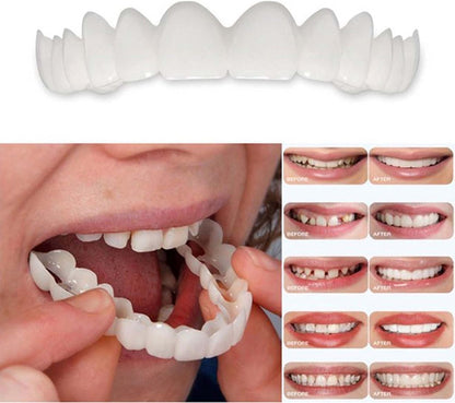 2 Pairs Temporarily Adjustable Smile Aligners – Natural & Comfortable for Men & Women (White)