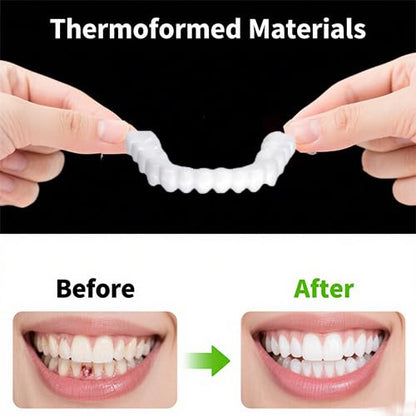 2 Pairs Universal Temporary Smile Solution - Adjustable Top/Bottom for All-Day Comfort