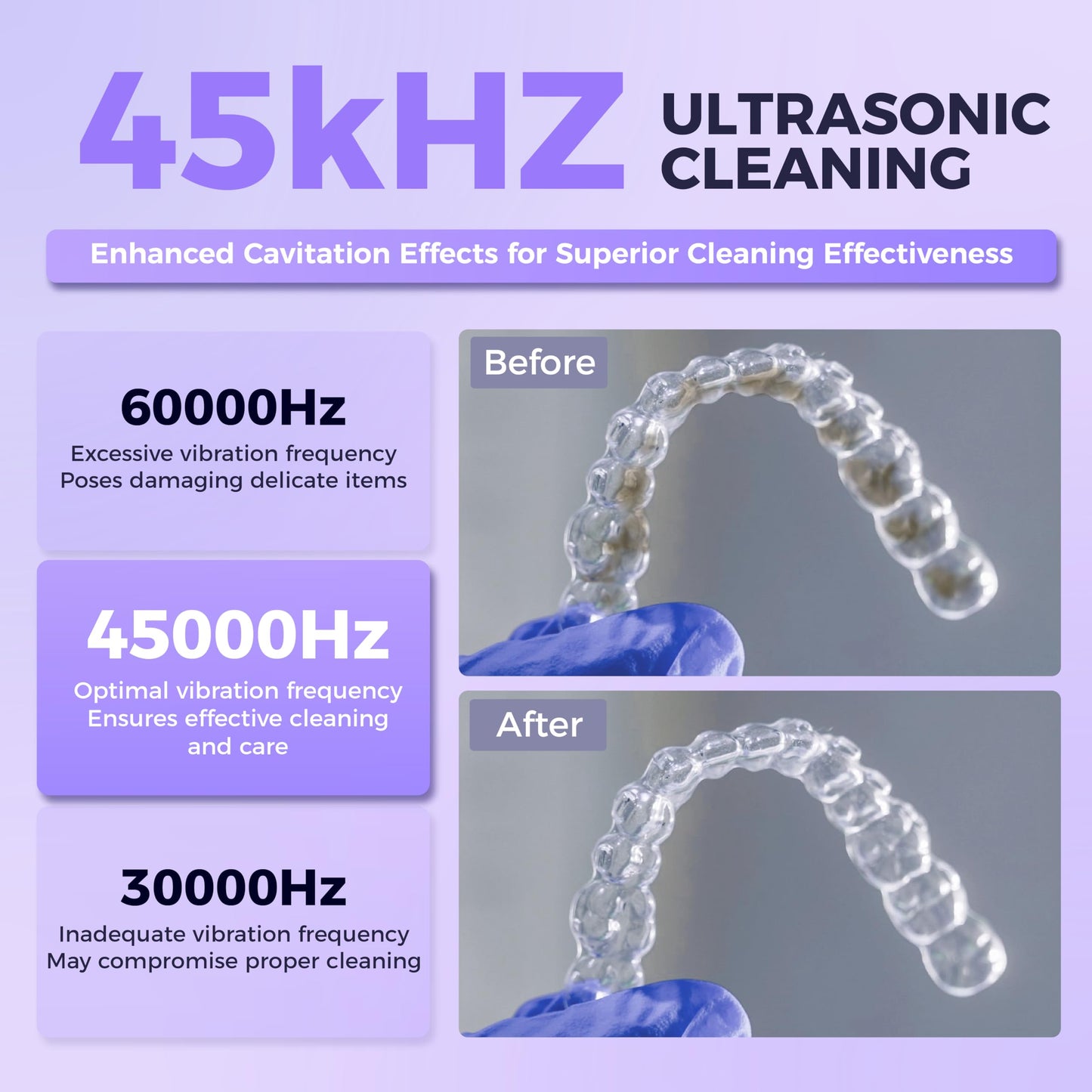 Ultrasonic Retainer Cleaner with UV Sterilizer | 45kHz Dental Cleaning Machine – Portable 200ML W190MAX (White)