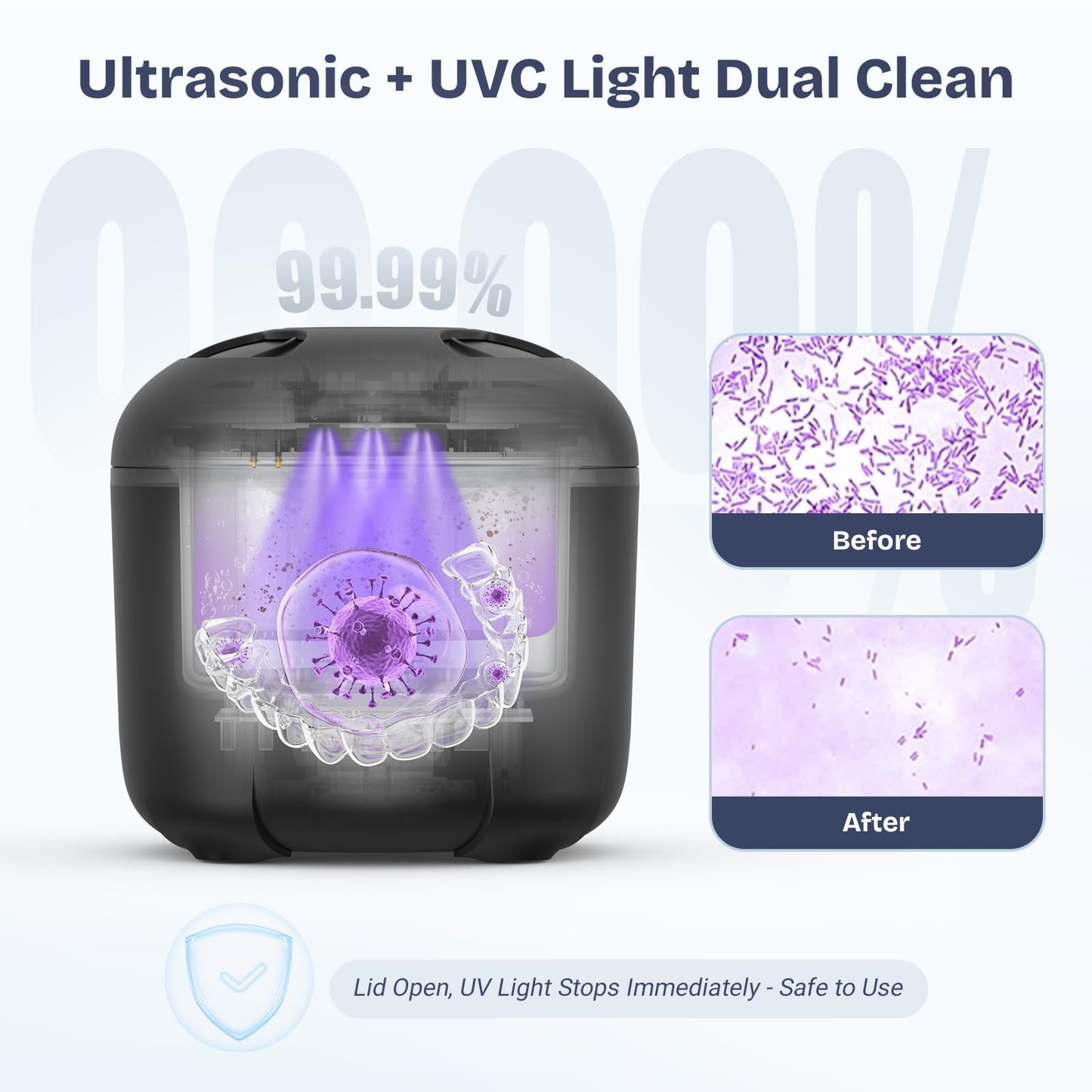 2025 Ultrasonic Retainer Cleaner – 45kHz, 25W with Drying (Black)