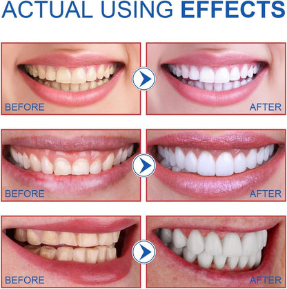 2PCS-SP-6 Whitening Toothpaste – Enamel-Safe, Fluoride-Free, Fresh Mint