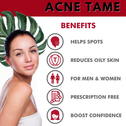 Acnetame Acne Pills – Acne Tame 3 Pack – Clear Skin Vitamins – 180 Tablets