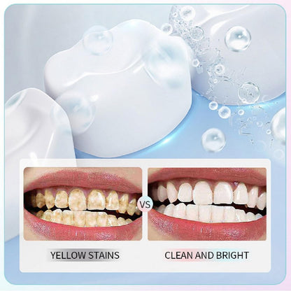 Niacinamide Whitening Toothpaste – Deep Stain Removal, Gum Health