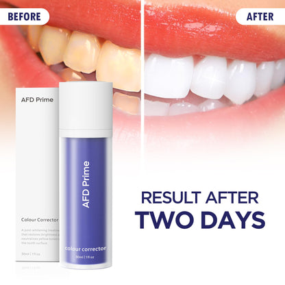 AFD Prime Purple Toothpaste – Color-Correcting, Peroxide-Free Teeth Whitening (130g)