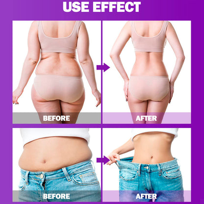 AICHUN BEAUTY Slimming Body Essential Oil Capsules – Anti-Cellulite & Fat Burning (400mg x 90pcs)