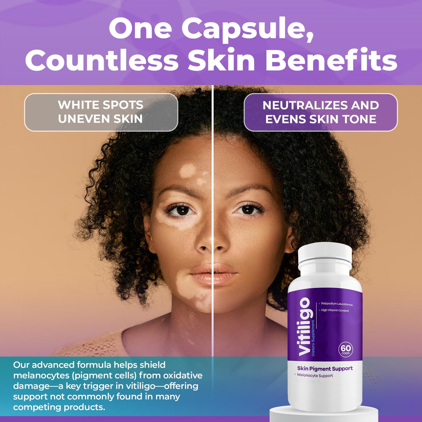 Aura Vitamins Vitiligo Capsules 60 Count | Support Skin Pigmentation & Reduce White Spots