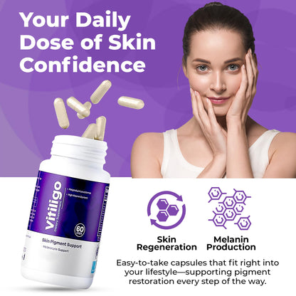 Aura Vitamins Vitiligo Capsules 60 Count | Support Skin Pigmentation & Reduce White Spots