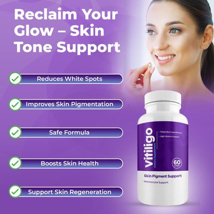 AURA VITAMINS Vitiligo Capsules – 60 Count | 1 Month Supply for Skin Pigmentation Support