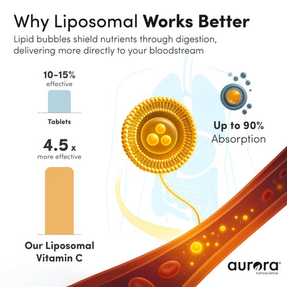 Aurora Nutrascience Micro-Pack Liposomal Vitamin C – Immune Support, 1,000 mg per Serving, Gluten Free, Non-GMO, 30 Packets (21.7 oz)