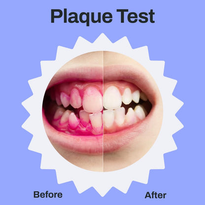 autobrush Kids Electric Toothbrush - ADA Accepted U-shaped, Clinically Proven 5.1x Cleaning (Ages 9-12) - Daniel Tiger