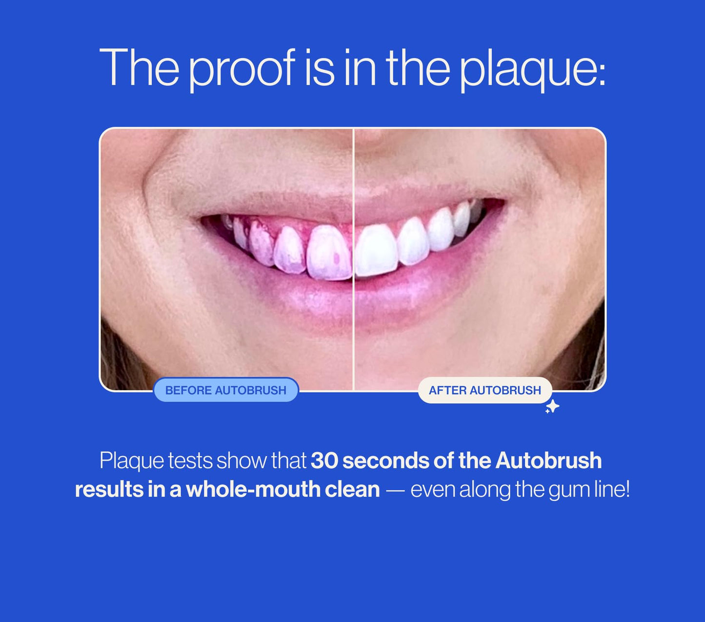 Autobrush Kids Electric Toothbrush – ADA-Approved U-Shaped, 5.1x Cleaning, Ages 6-8 | Lion