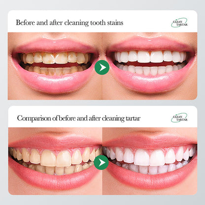 BIOAQUA 1.5X Instant Whitening Toothpaste - Balance Oral Flora & Gum Care 100g