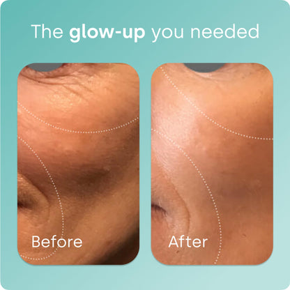 BioSil Collagen Generator - 120 Capsules with Patented ch-OSA Activator for Skin, Hair, Nails & Joints