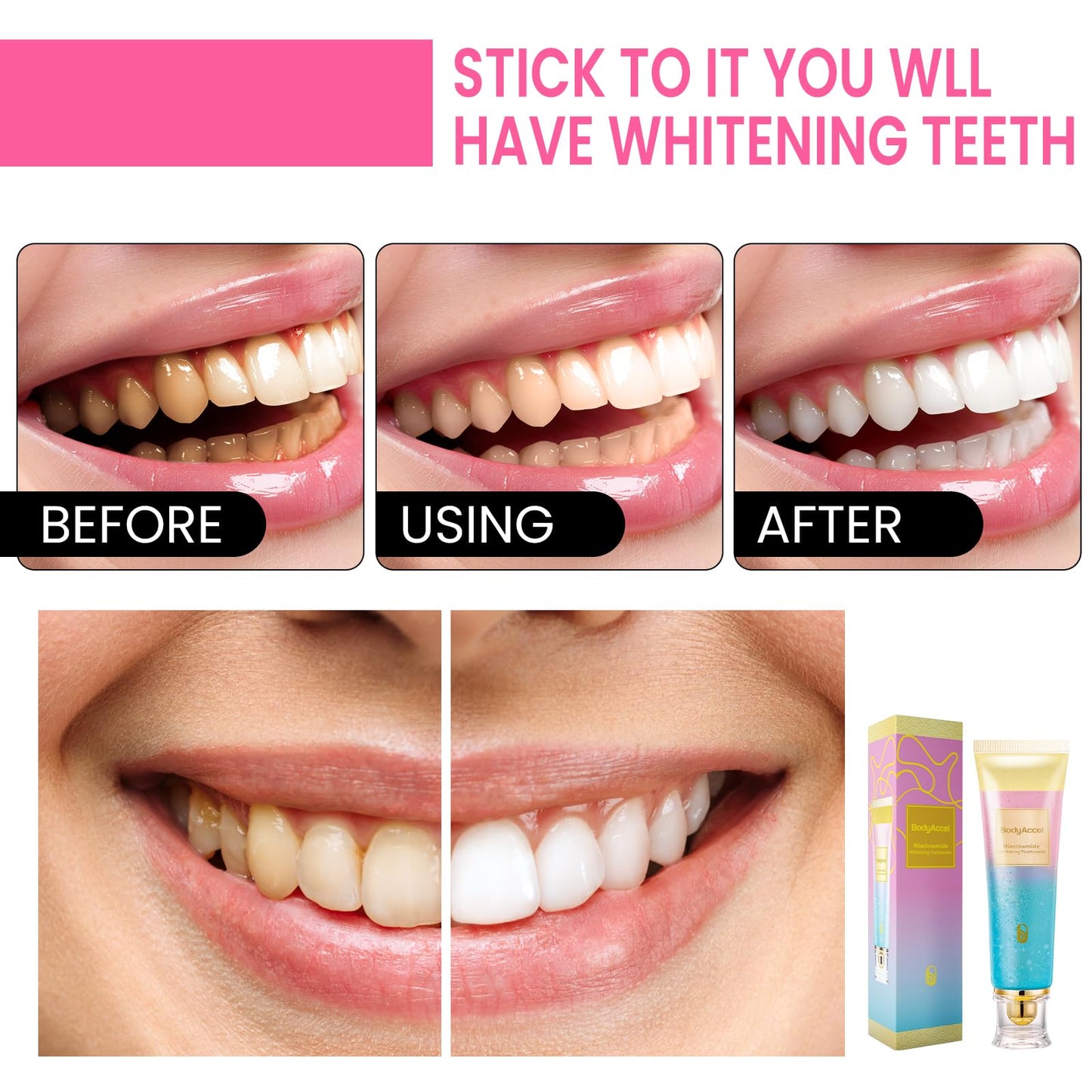 2 Pack BodyAccel Niacinamide Whitening Toothpaste – Triple Whitening, Gentle Formula, Fresh Breath