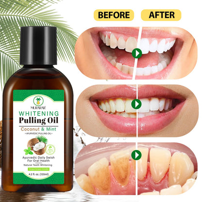 2 Pack Coconut Mint Oil Pulling Mouthwash 4.2 fl oz – Fresh Breath & Tongue Scraper