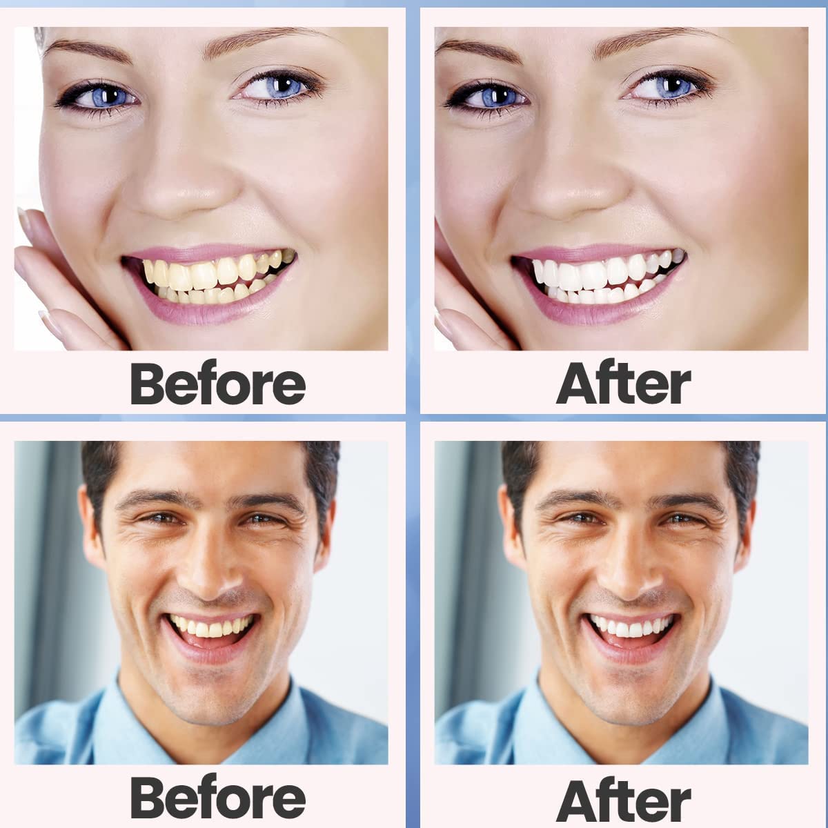 Teeth Whitening Strips – 28 Pcs, 14 Treatments, Safe for Sensitive Teeth