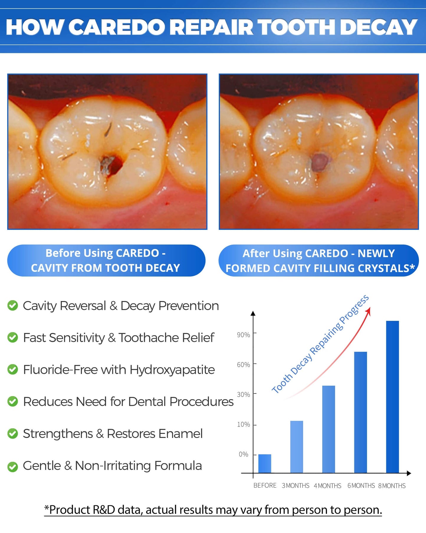 CAREDO Cavity Repair Toothpaste – Hydroxyapatite Remineralizing, Fluoride-Free