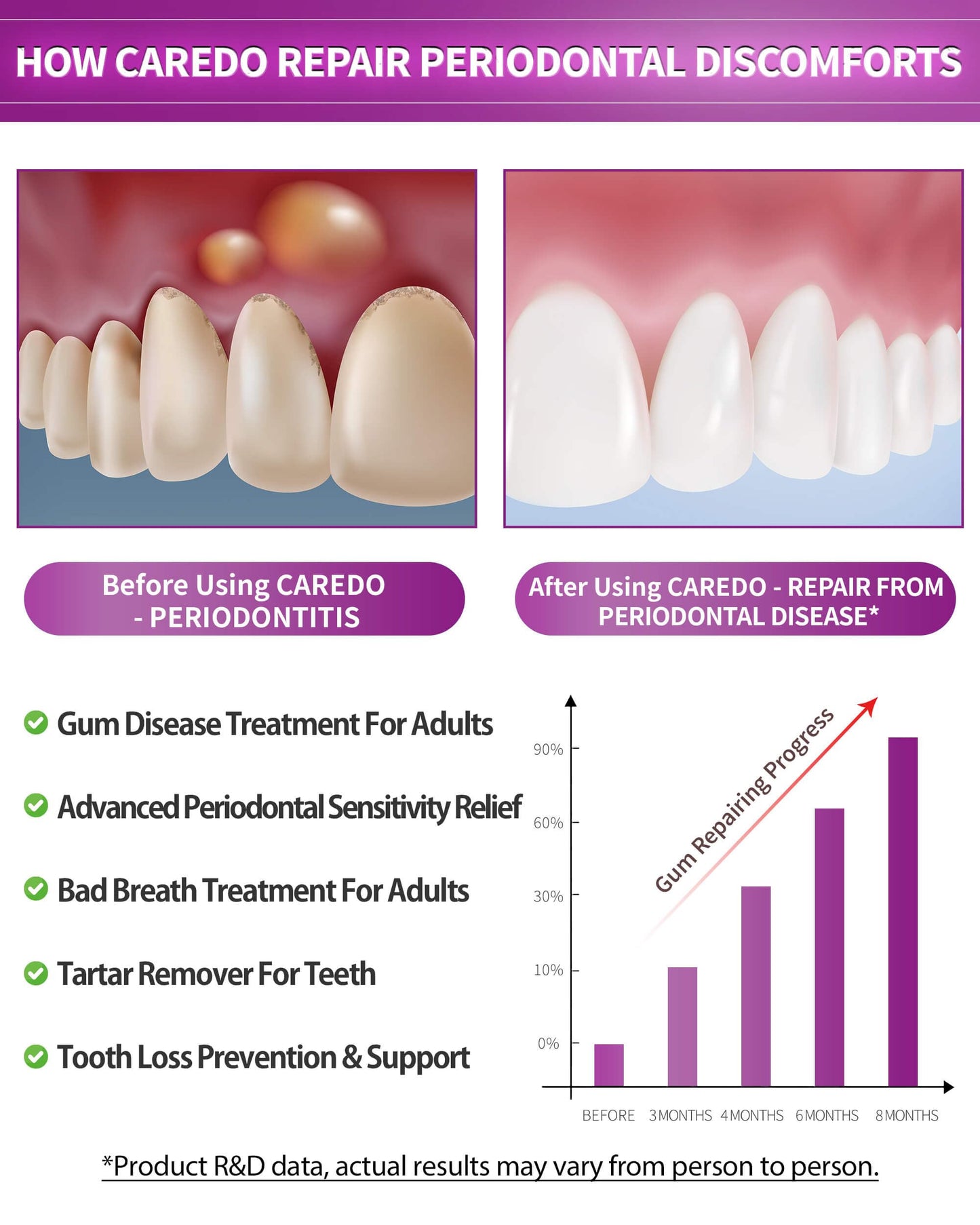 CAREDO Gum Toothpaste for Periodontitis | Gum Health & Receding Gums - 2 Pack