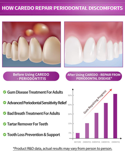 CAREDO Gum Toothpaste for Periodontitis | Gum Health & Receding Gums - 2 Pack