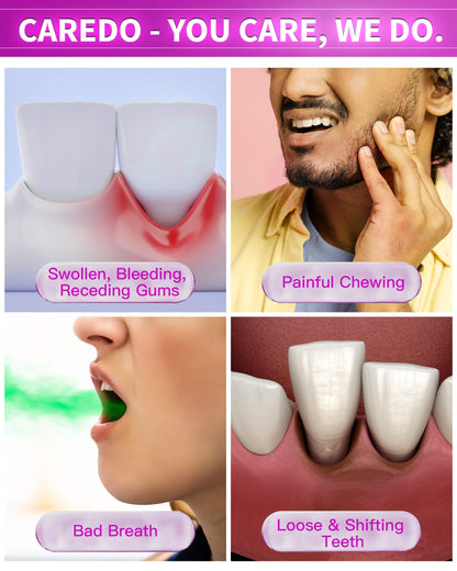 CAREDO Gum Toothpaste for Periodontitis | Gum Health & Receding Gums - 2 Pack