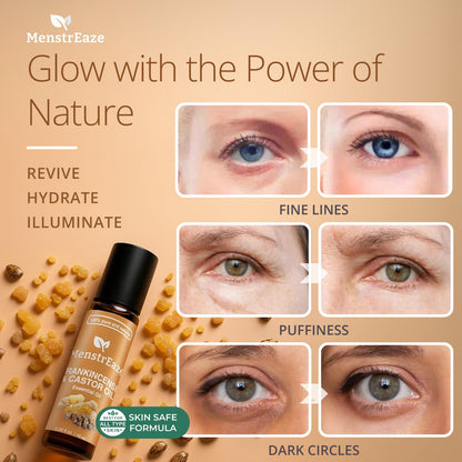 Castor Oil Roll-On with Frankincense for Eyes – 10ml
