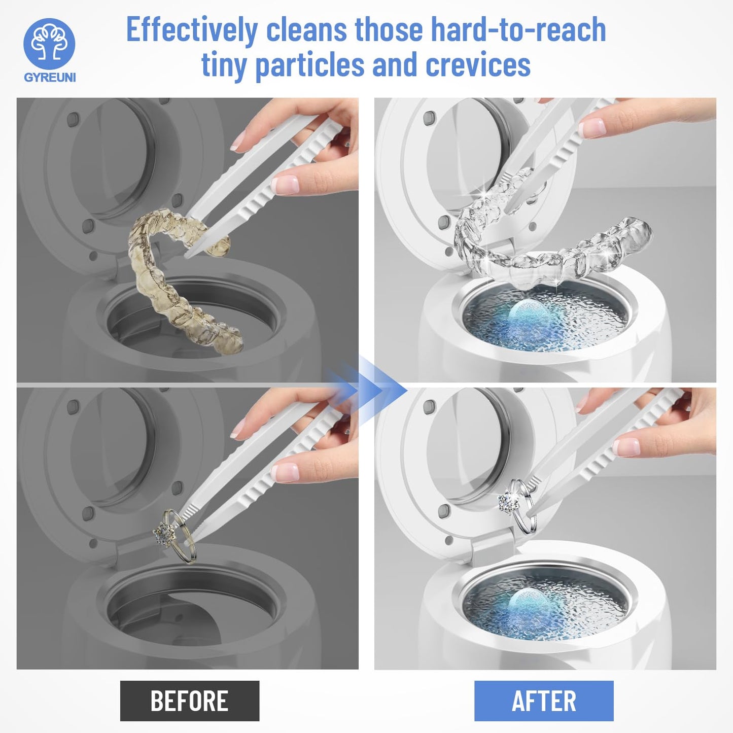 Ultrasonic Retainer Cleaner with Tablets and Brush Kit - UV Sonic Cleaner