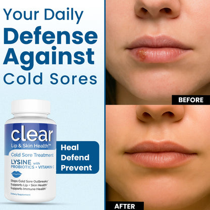 Clear Probiotics Lysine Cold Sore Treatment for Lips – Probiotic Lysine + Vitamin C – 180 Capsules