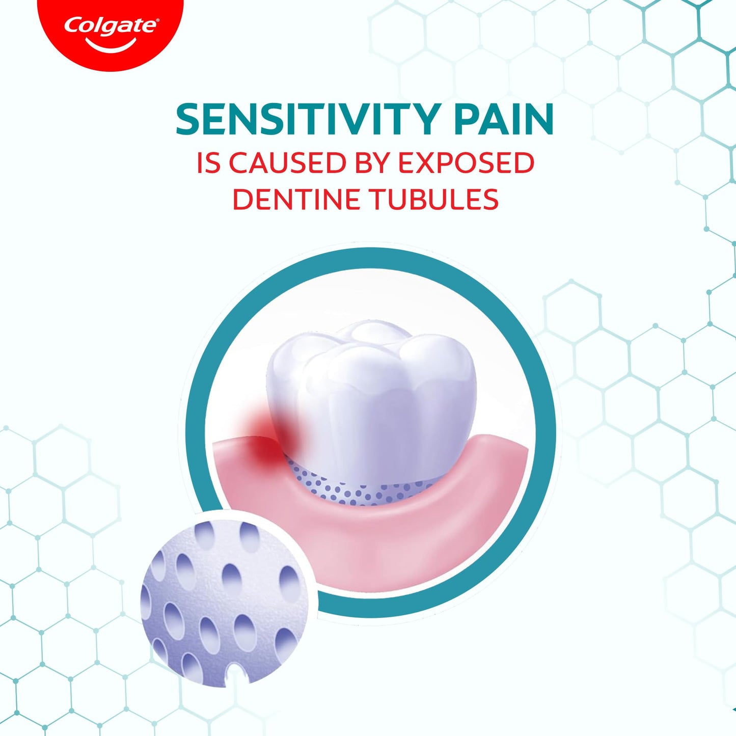 Colgate Toothpaste Sensitive Plus - 70g (Sensitivity)
