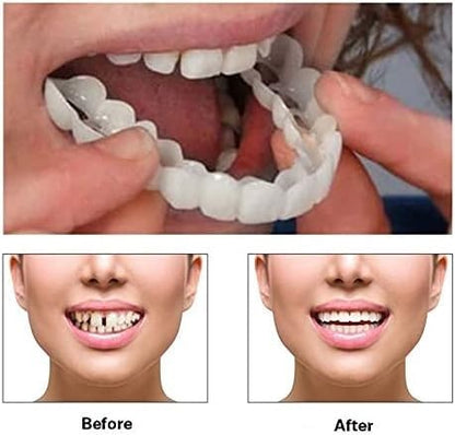 2 Pairs Temporarily Adjustable Smile Aligners – Natural & Comfortable for Men & Women (White)