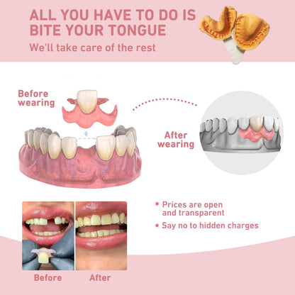 Custom Partial Dentures – Personalized Removable Denture Set for Missing Teeth | 1–6 Tooth Replacement with Storage Case | Natural Look & Comfortable Fit (1 Tooth)