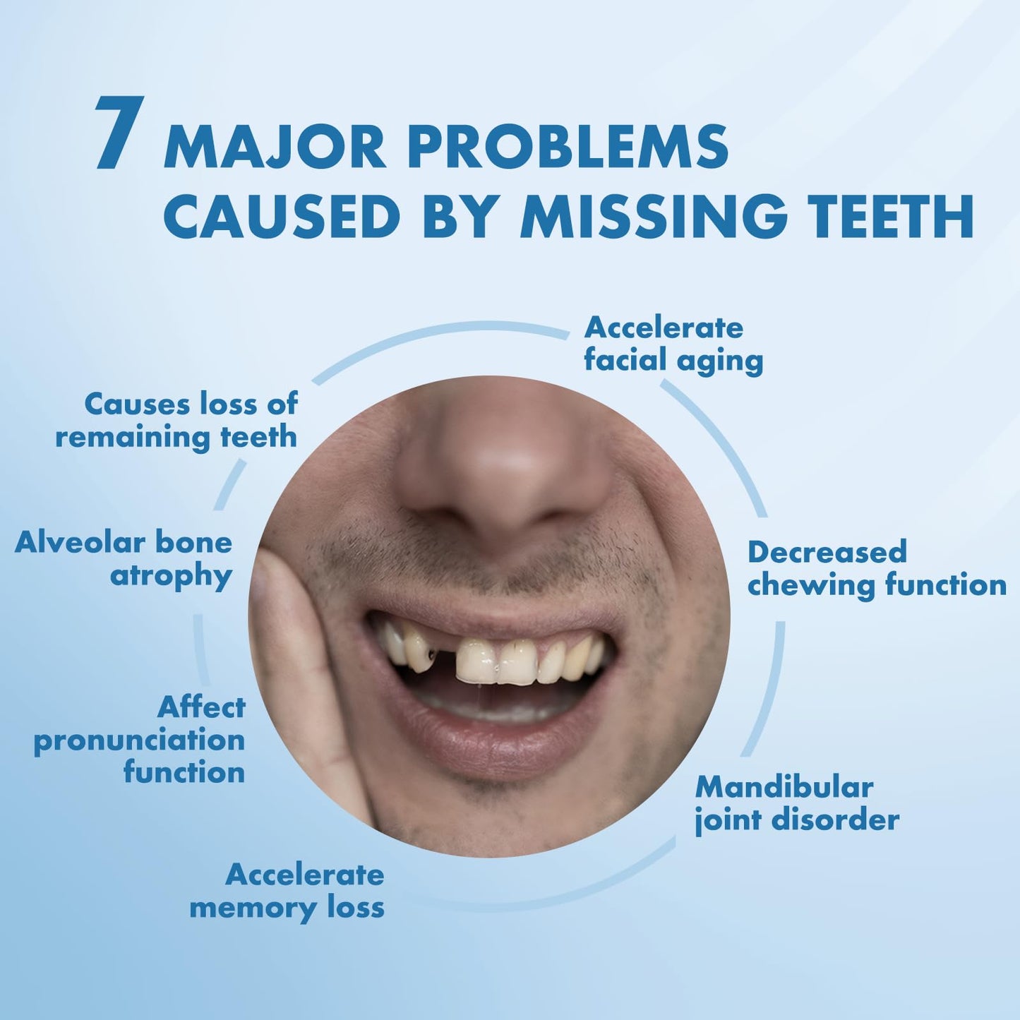 Custom Removable Dentures – Personalized Partial Denture Set with Storage Case | 1–6 Teeth Coverage
