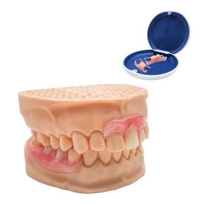 Custom Partial Dentures – Removable Denture Set for Missing Teeth (1-6) with Case | Natural Look & Comfortable Fit