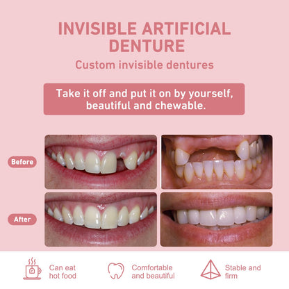 Custom Partial Dentures – Personalized Removable Denture Set (1–6 Teeth) with Storage Case