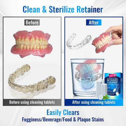 Retainer Cleaner Tablets for Invisalign - 120 Sulphate-Free Kit