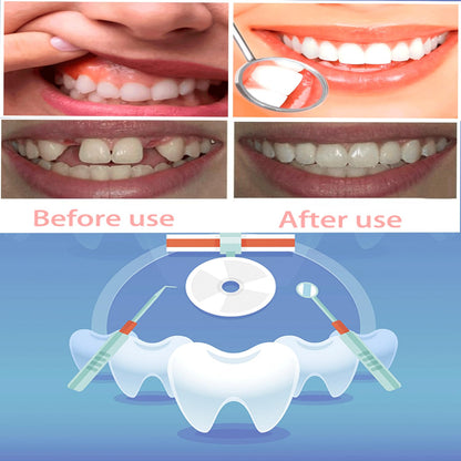 Denture Do It Yourself Full Set - Top & Bottom Dentures, Partial & Full Dentures DIY Kit | Create Your Perfect Smile at Home