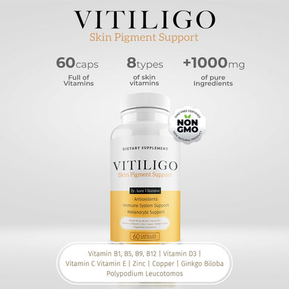 Dermawonder Vitiligo Capsules 60 Count - Support Pigmentation & Reduce White Spots