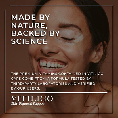 Dermawonder Vitiligo Capsules 60 Count | Effective Pigmentation Support & White Spot Reduction