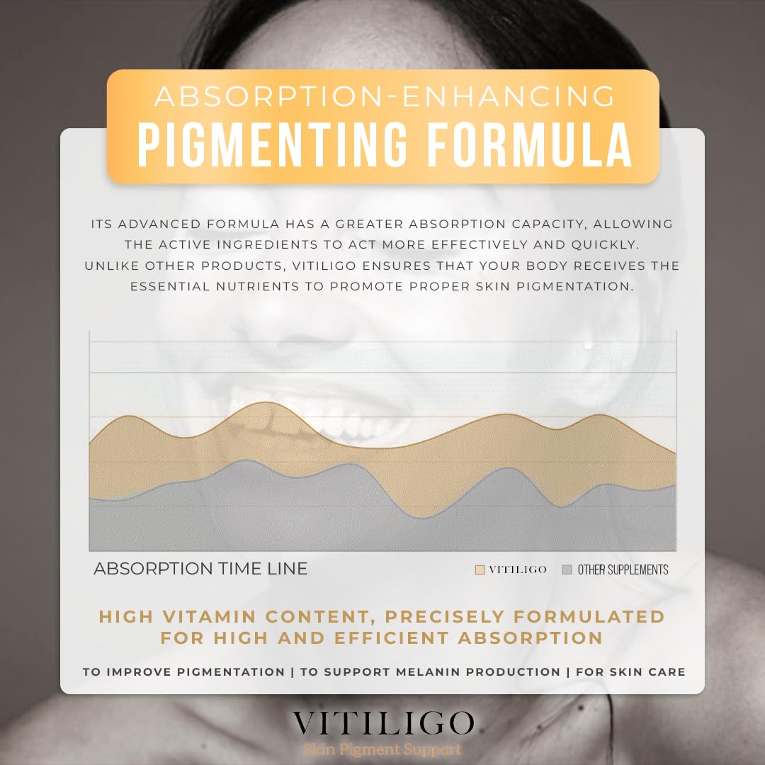 Dermawonder Vitiligo Capsules 60 Count | Effective Pigmentation Support & White Spot Reduction