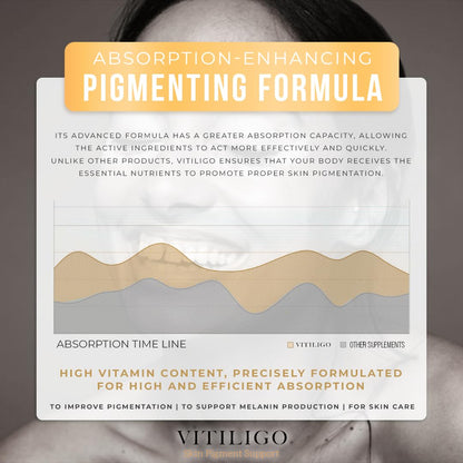 Dermawonder Vitiligo Capsules 60 Count | Effective Pigmentation Support & White Spot Reduction