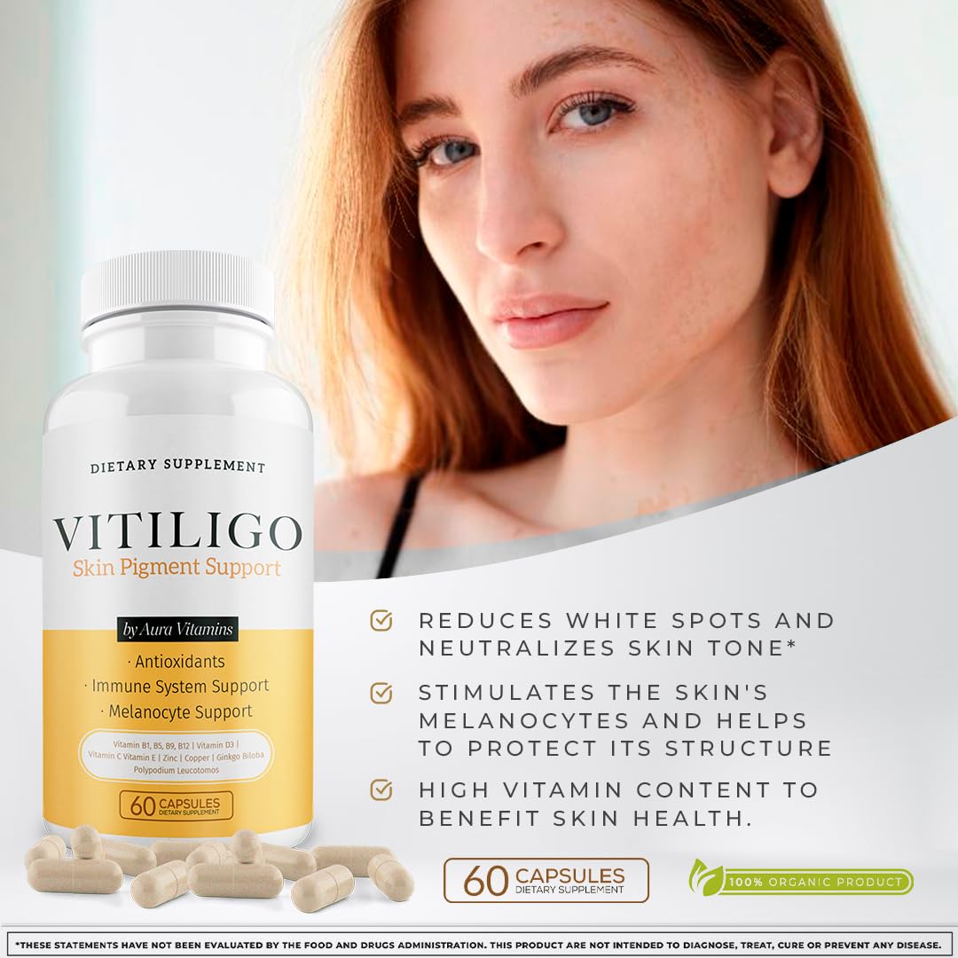 Dermawonder Vitiligo Capsules 60 Count | Effective Pigmentation Support & White Spot Reduction
