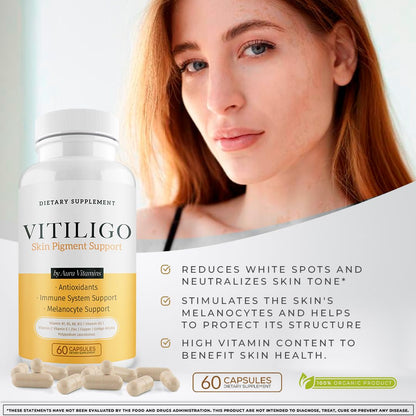 Dermawonder Vitiligo Capsules 60 Count | Effective Pigmentation Support & White Spot Reduction