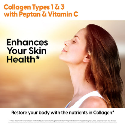 Doctor's Best Collagen Types 1 & 3 with Peptan – 1000 mg per Tablet, 540 Tablets, Non-GMO, Gluten Free, Soy Free