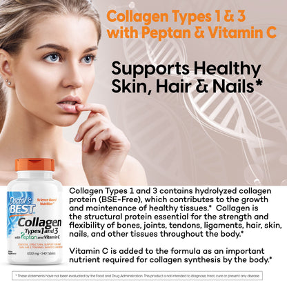 Doctor's Best Collagen Types 1 & 3 with Peptan – 1000 mg per Tablet, 540 Tablets, Non-GMO, Gluten Free, Soy Free