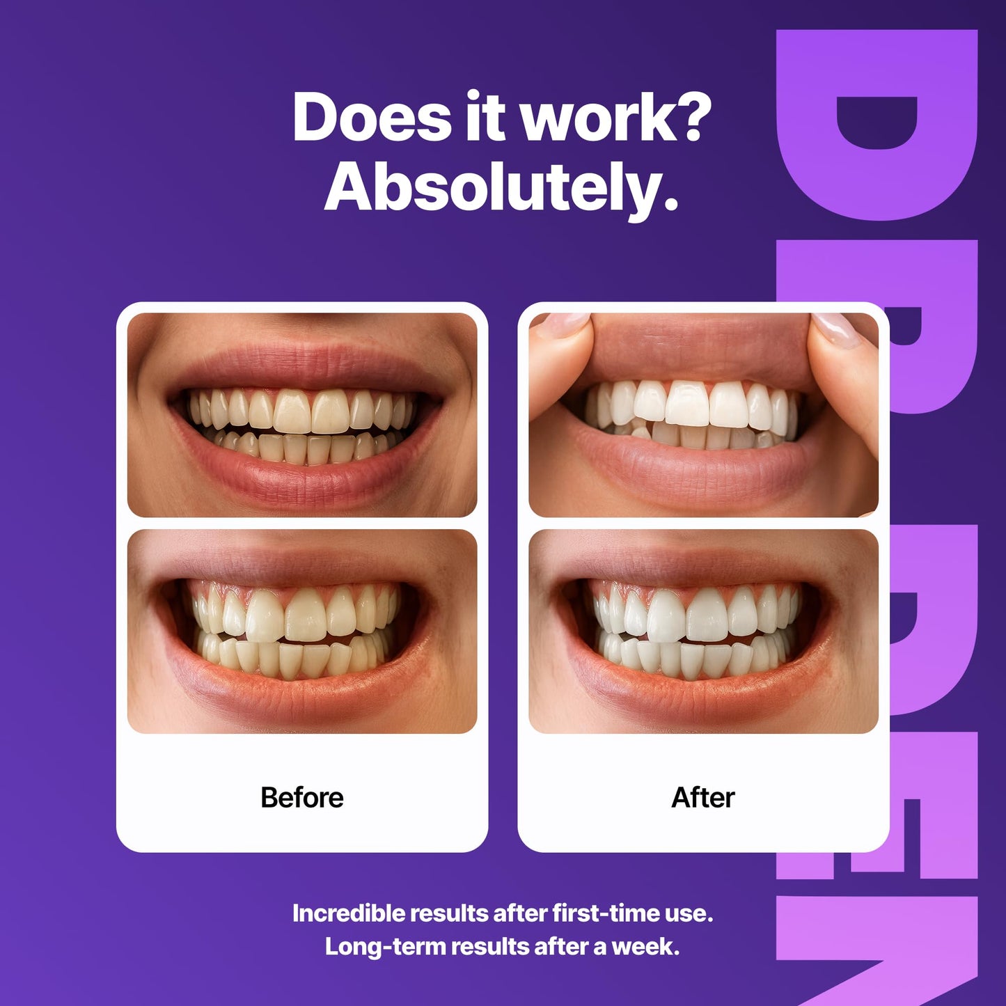 DRDENT Purple Teeth Whitening Strips - Safe for Enamel, 42 Strips