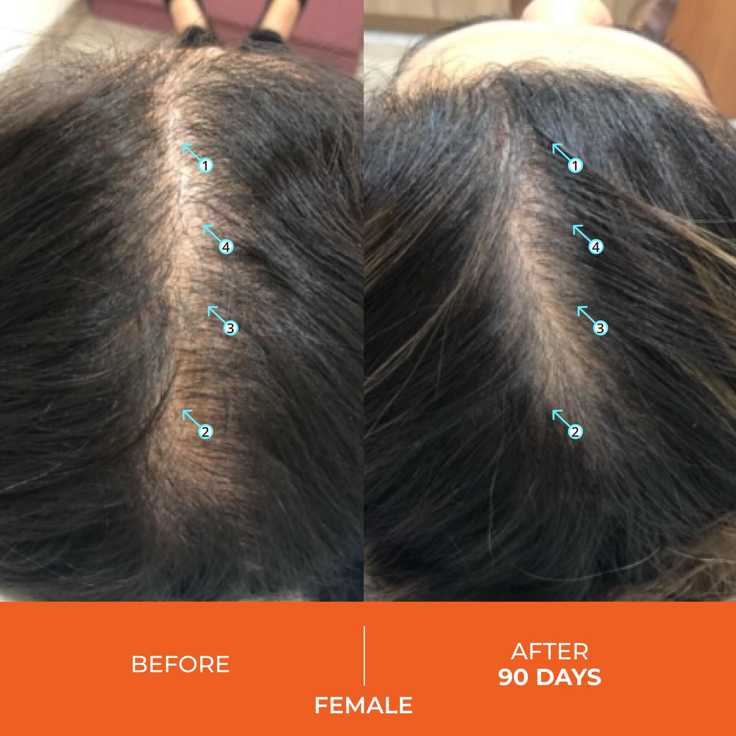 DS Laboratories Revita Hair Vitamin Gummies – Vegan, Gluten‑Free Hair Support for Fuller-Looking Hair