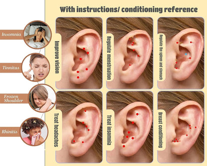 Ear Seeds Acupuncture Kit – Auriculotherapy for Balance & Wellness (Chart + Brass Probe)